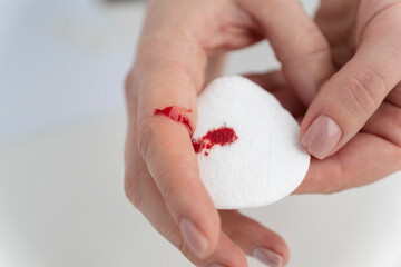 close up image of bleeding finger of young female, cotton pad collecting blood. Accident due to...