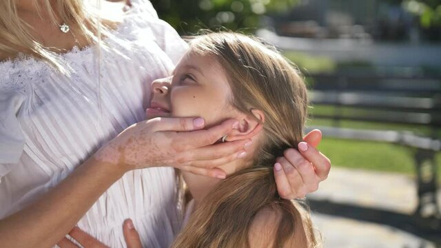 Close-up of caring female hands with vitiligo spots gently stroking face of happy preteen daughter during joint leisure in city park. Smiling girl putting head on mother's chest enjoying her caress