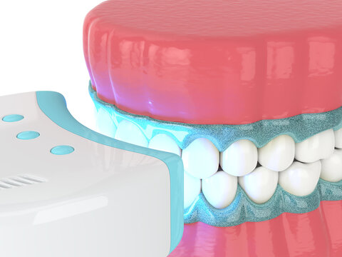  3d render of jaw with teeth bleaching by uv lamp