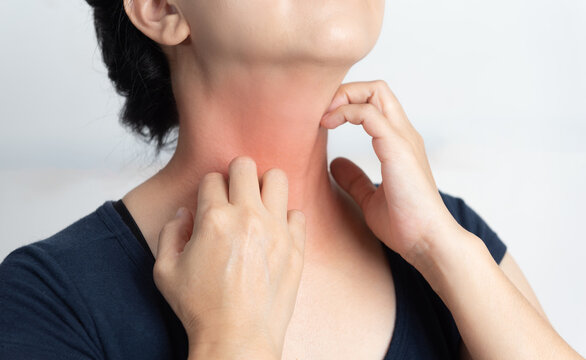 Itching of skin diseases in women using the hand-scratching. Red around the Itching area. Concept with Healthcare And Medicine.