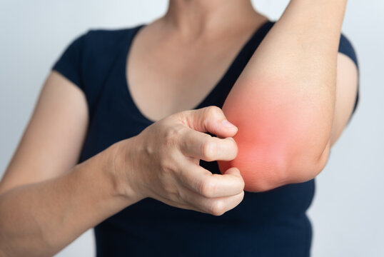 Itching of skin diseases in women using the hand-scratching. Red around the Itching area. Concept with Healthcare And Medicine.