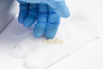 Fototapeta premium Four veneers are on gauze. Aesthetic restoration of the oral cavity with veneers.