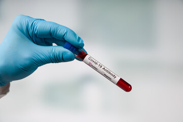 hand in medical gloves holding a blood test tube for virus analysis with result markers in front of...