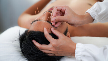 Acupuncture needles, A man was treated by a Chinese alternative medicine with facial acupuncture.
