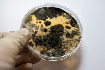 hand holding a petri dish with bacteria, close up shot