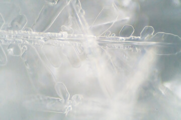 The Microscopic World. Snowflake under microscope.