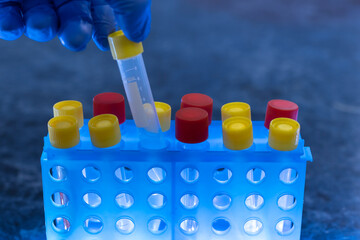 Close-up, a scientist with a gloved hand pulls a test tube with a yellow stopper from a blue...