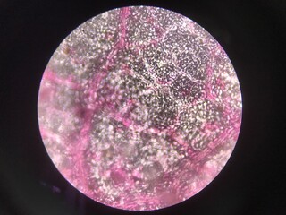 Plants cells find with microscope.