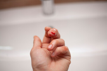 The man cut his finger. A cut. Blood flows from the finger