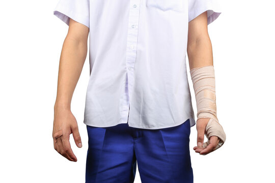 Student in school uniform with broken arm. Close up hand and arm broken in cast. 