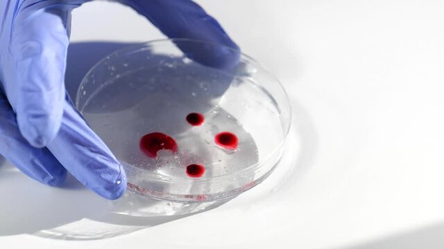 scientist in medical gloves adding blood or chemical reagent sample on petri dish, performing analysis. Drops for testing in laboratory