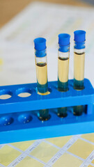 Test tubes with urine on medical color schemes. The concept of laboratory analyzes, ph control....