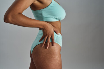 Cropped shot of female body with stretch marks. Young woman in blue underwear posing isolated over grey background