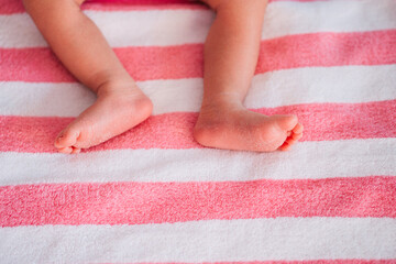 The skin on the feet of a newborn baby is peeled off. The skin on the foot is dry.
