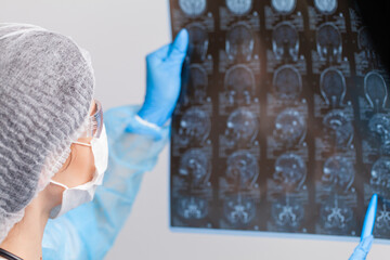 Beautiful female radiologist looking at the MRI scan images