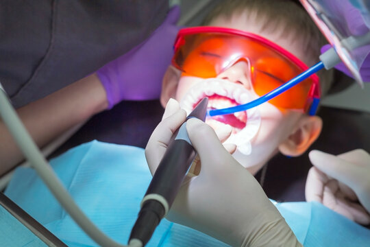 Kids dentistry. Children's dentist examination baby teeth. Emotions of a child in a dental chair. Little boy in protective orange glasses and cofferdam. Process treatment caries.