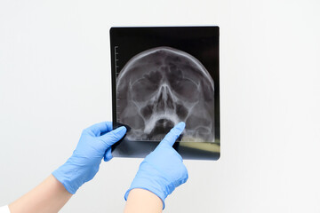 X-ray of the skull in the hand of a  doctor. With copy space.