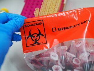Microcentrifuge tube with blood contained in a biohazard specimen transport bag. Biological risk. Bag for specimen transporting. - obrazy, fototapety, plakaty