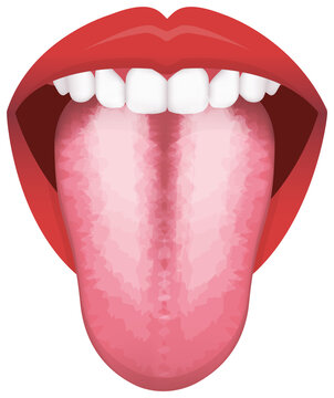Tongue’s health sign vector illustration ( White coated Tongue )