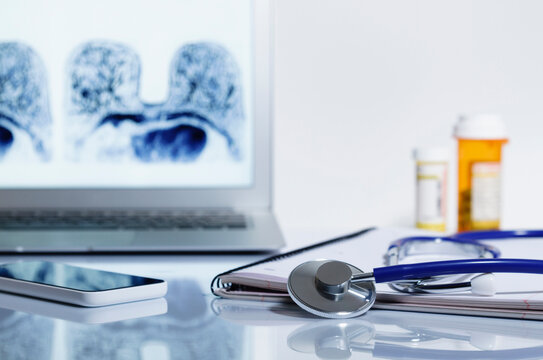 Acoustic stethoscope and laptop displaying MRI image