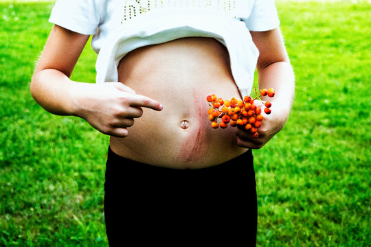Girl pointing at scratches on her stomach