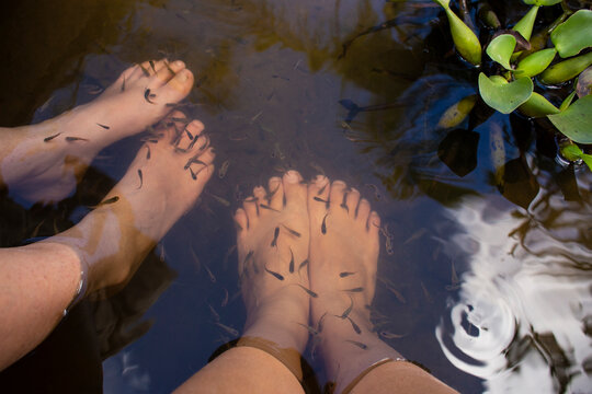 Ichthyotherapy - Ictioterapia en laguna el Oconal de Villa Rica