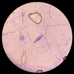 Microscopic finding shows macroconidia of Microsporum canis in dog with skin disease. a ringworm...