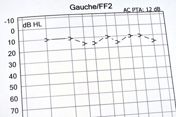 Détail d'un test auditif en gros plan