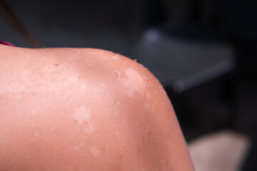 Sun tan on skin close up