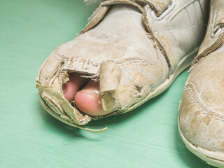 Toe looks out of a totally worn and broken sports shoe