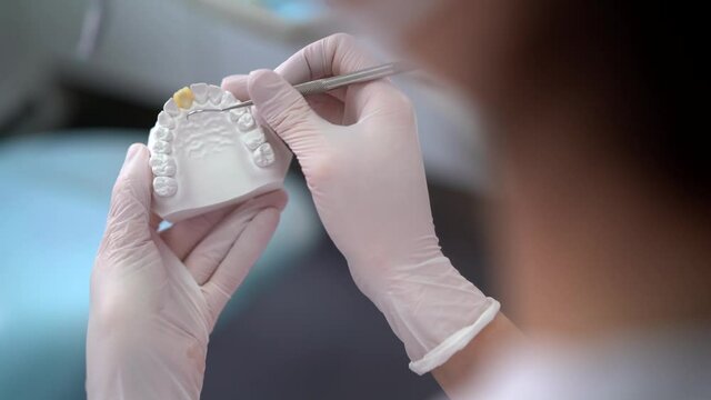 Crop dentist making cast of jaw