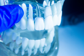 Dental tooth implant model