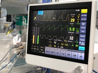The medical ventilator monitoring screen in operating room.