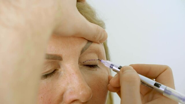 Blepharoplasty markup close-up on the face before the plastic surgery operation for modifying the eye region of the face in medical clinic. Doctor doing plastic cosmetic operation