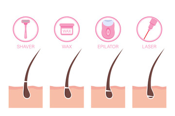 Different methods of hair removal and types of epilation. Flat style vector illustration with copy space for design