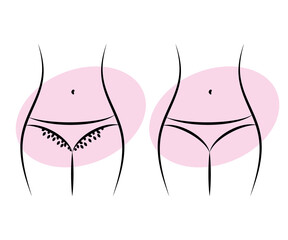 Bikini area depilation. Silhouette of a woman. Vector illustration.