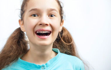 Portrait of teen girl showing dental braces.