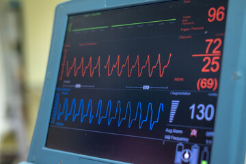 Obraz premium EKG monitor in intra aortic balloon pump machine. Medical equipment