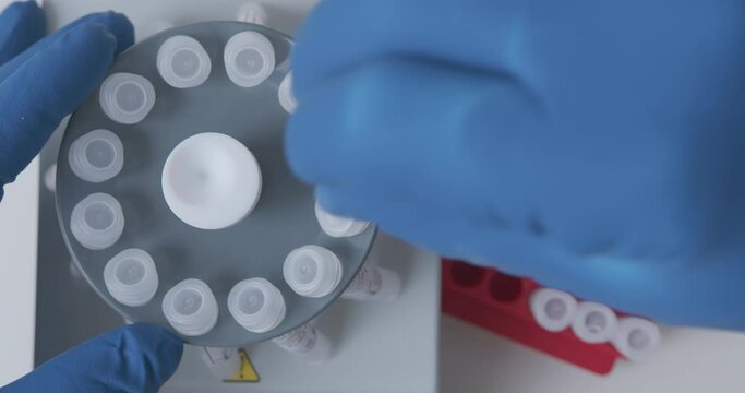 Lab technician loads the samples with the sample into the laboratory centrifuge