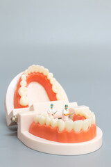 Miniature people : Dentist repairing human teeth with gums and enamel , Health and medical concept