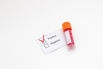 Obraz premium Positive test and laboratory sample of blood testing tube.