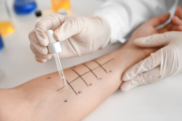 Young woman undergoing procedure of allergen skin tests in clinic © Pixel-Shot