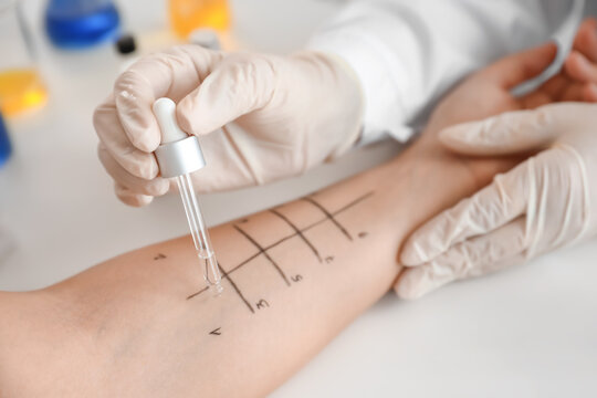 Young woman undergoing procedure of allergen skin tests in clinic
