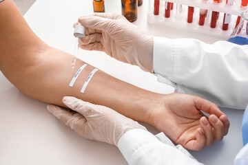 Young woman undergoing procedure of allergen skin tests in clinic