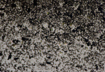 Cryptococcus neoformans is an encapsulated yeast India ink preparetion.