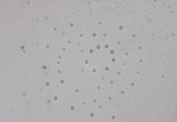 Cryptococcus neoformans is an encapsulated yeast India ink preparetion.