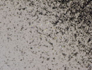 Cryptococcus neoformans is an encapsulated yeast India ink preparetion.