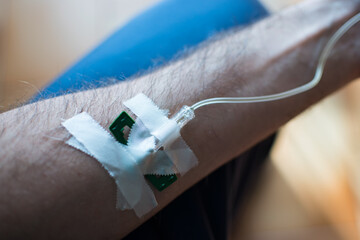 Detail of arm with drip attached