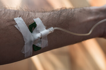 Detail of arm with drip attached