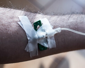 Detail of arm with drip attached